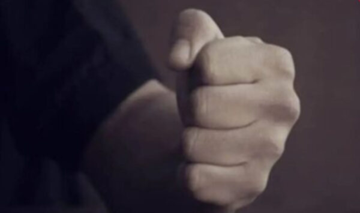 Βόλος: Θύματα άγριου ξυλοδαρμού ένας 12χρονος και η μητέρα του