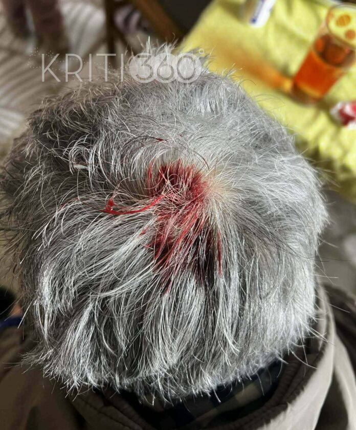 Τρόμος στην Κρήτη: Δύο μεγαλόσωμα σκυλιά επιτέθηκαν σε 76χρονη – Την έστειλαν στο νοσοκομείο - Σοκαριστικές εικόνες