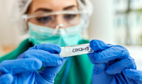 COVID 19 ΚΟΡΩΝΟΙΟΣ