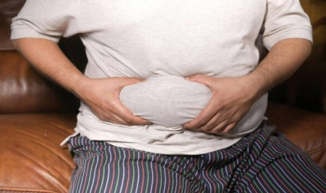 παχυσαρκία