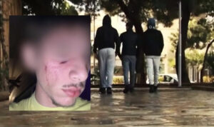Άγριος ξυλοδαρμός 16χρονου σε πανηγύρι στην Λάρισα: «Θα σε σκοτώσω, πώς είσαι έτσι»