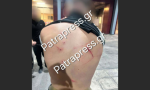 Πάτρα: Χτύπησαν 18χρονο με κατσαβίδι 13 φορές και πήγαν να τον πετάξουν στη θάλασσα (φώτο)